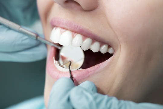 stomatolog ogląda zęby